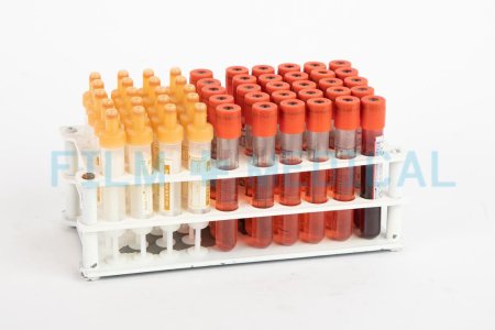Vacutainers in Rack